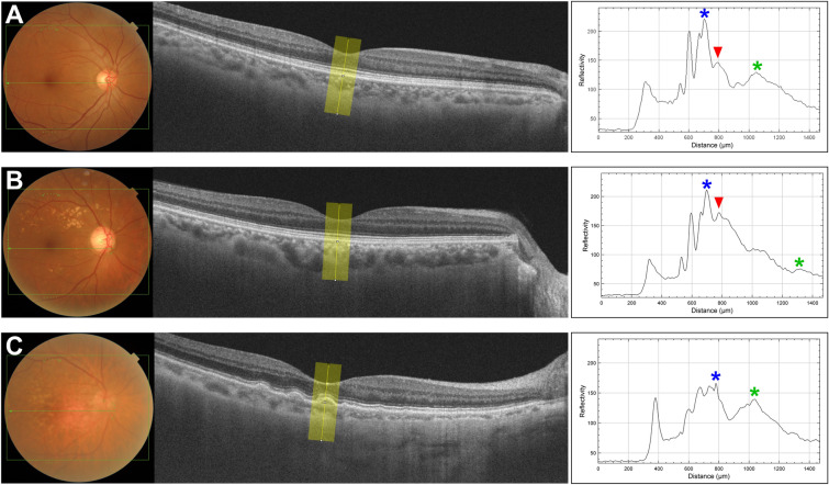 Fig. 2