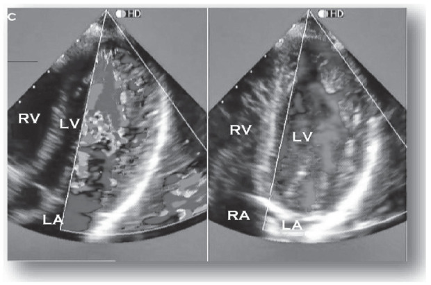 Fig. (1)