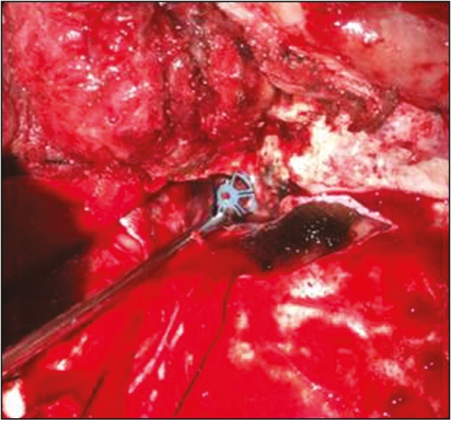 Figure 7