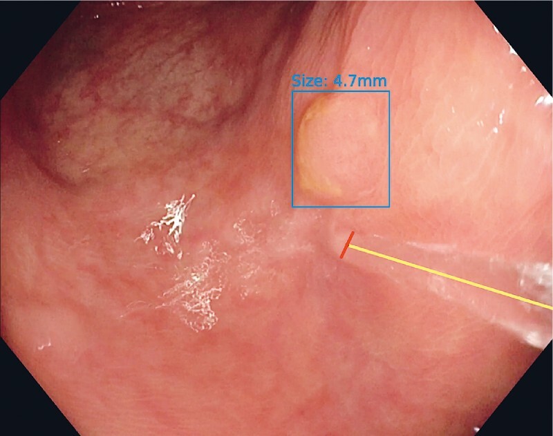 Fig. 1 