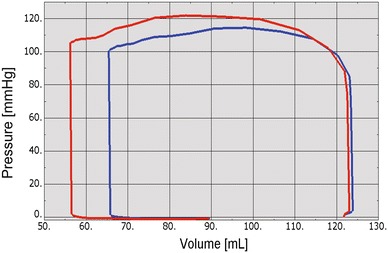 Figure 13