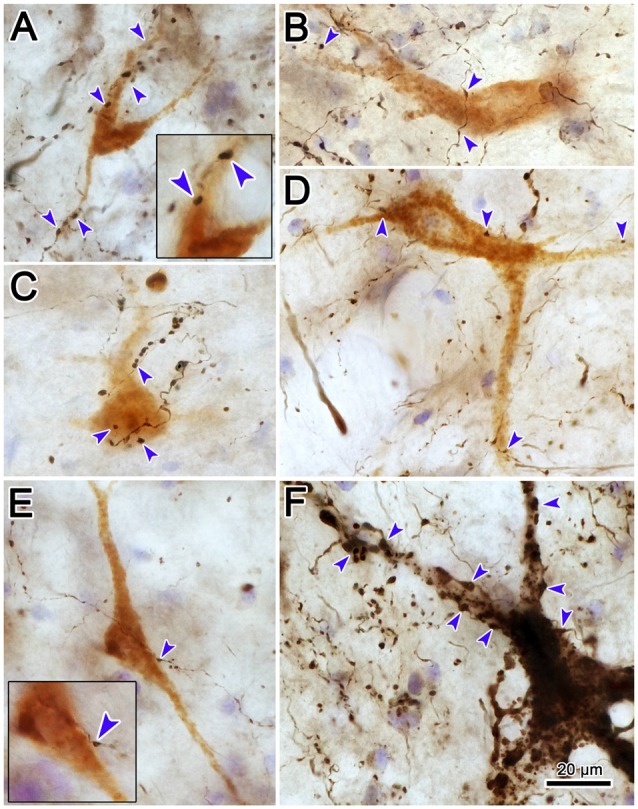 Figure 13