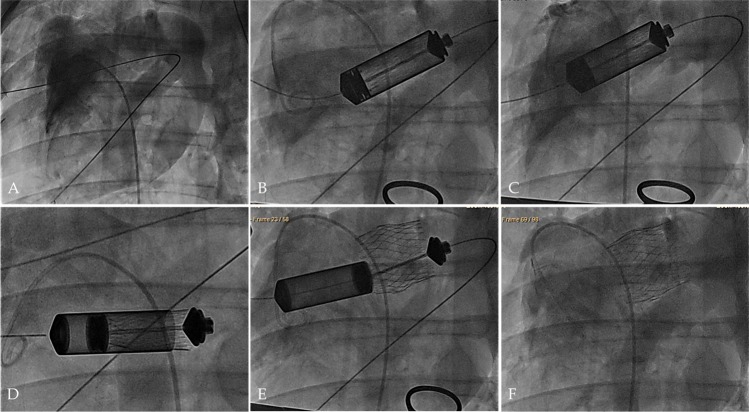 Fig. 4