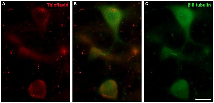 FIGURE 13