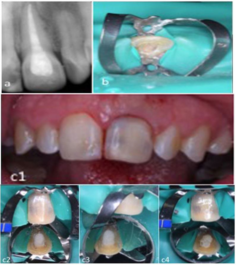 Figure 2