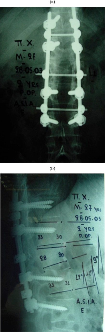 Fig. (2)