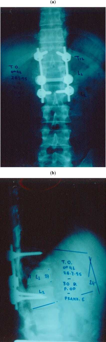 Fig. (1)