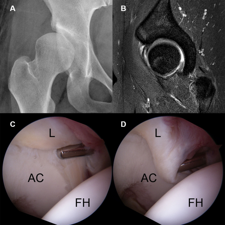 Fig 4