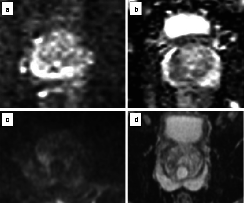 Fig. 11