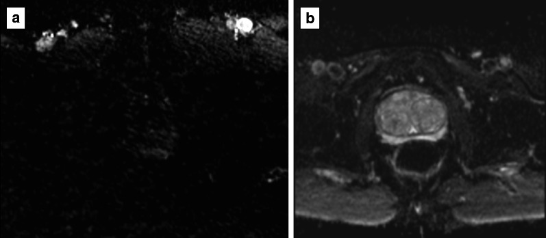 Fig. 13