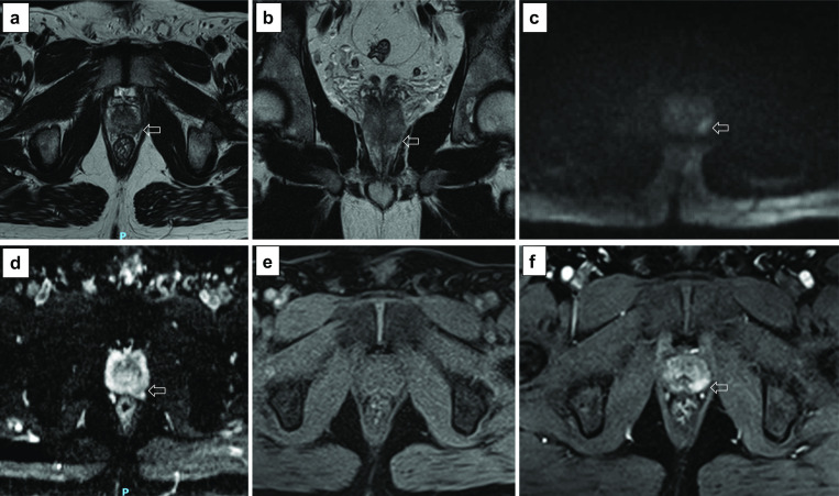 Fig. 24