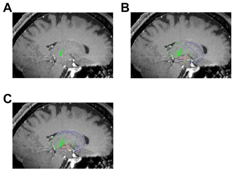 Fig. (5)