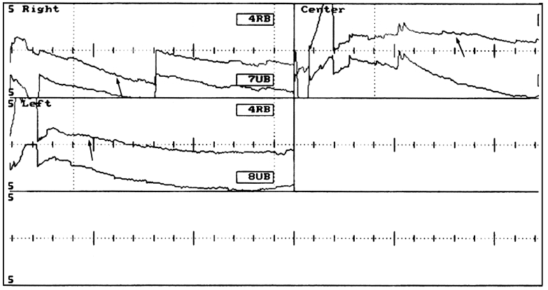 Fig. 5