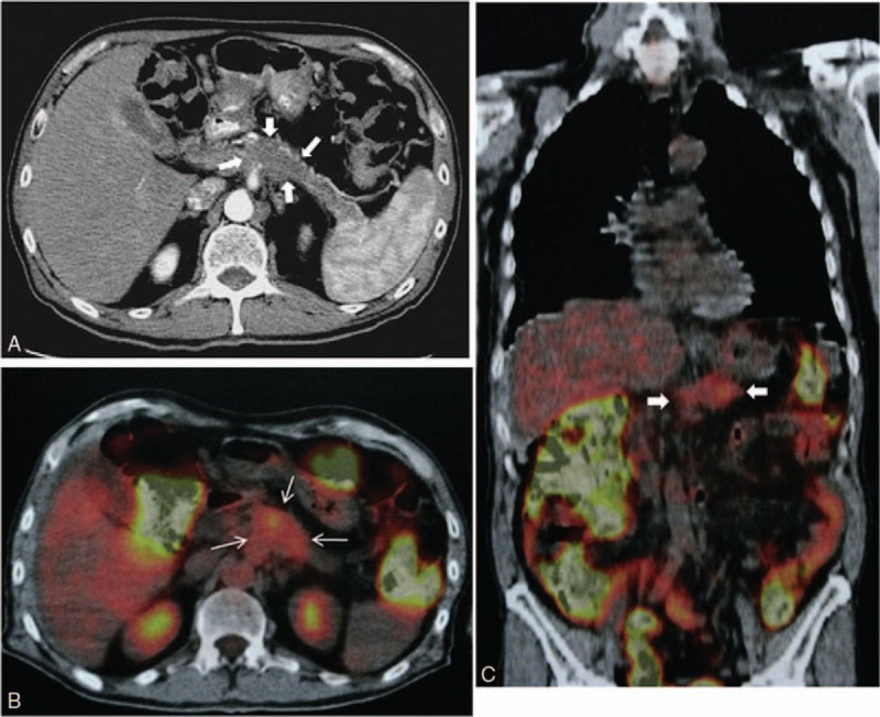 FIGURE 1