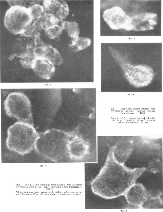 Fig. 1 To 5