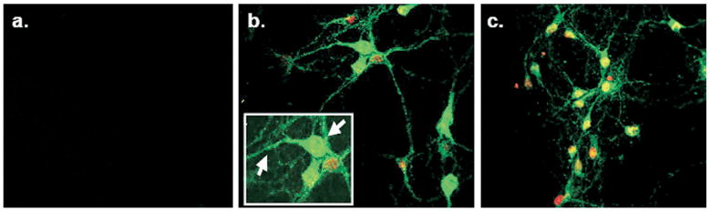 Fig. 11