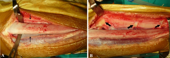 Fig. 2A–B