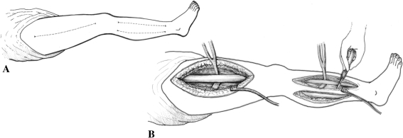 Fig. 1A–B