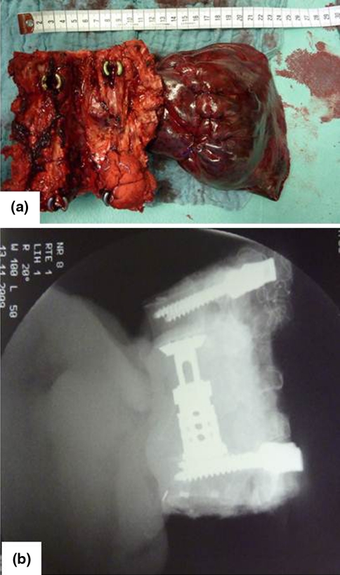 Fig. 6