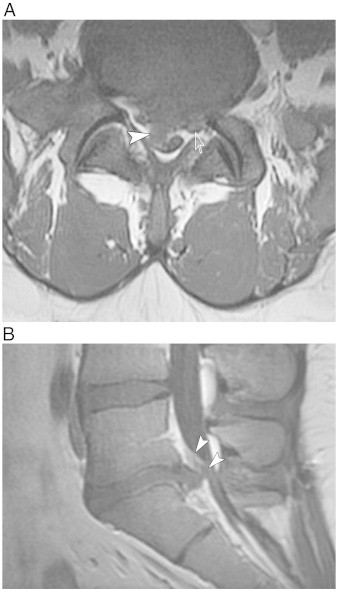 Fig 1