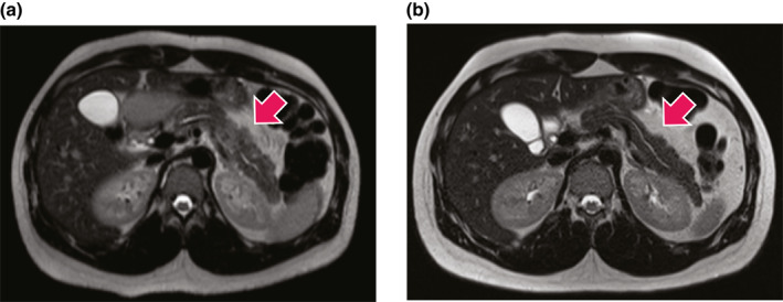 FIGURE 3