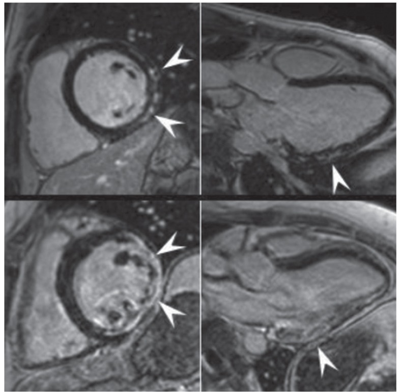 Fig. 4