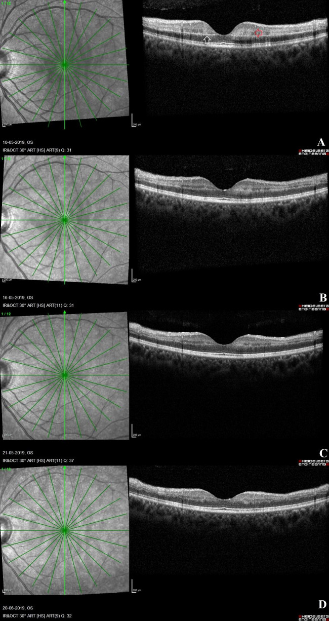 Fig. 2