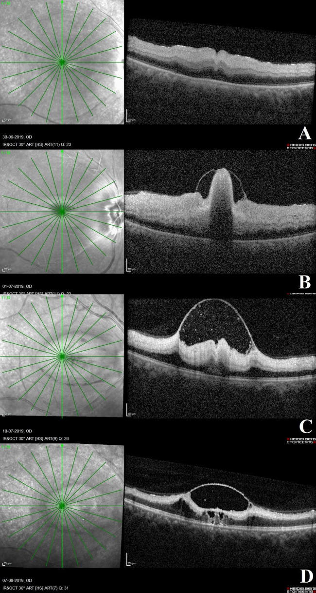 Fig. 4