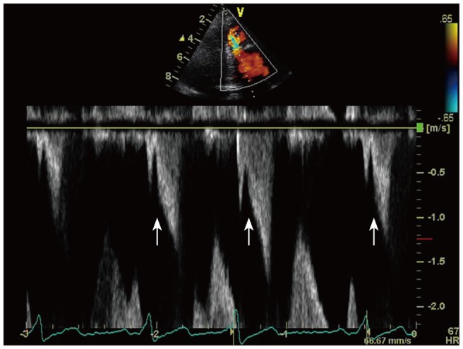 Fig. 3