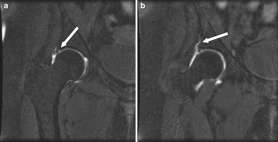 Fig. 6