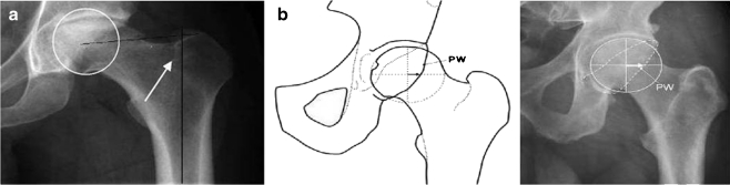 Fig. 4 (a & b)