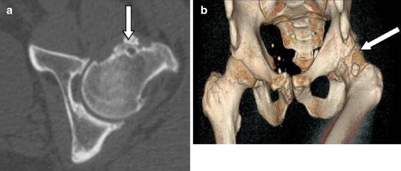 Fig. 8 (a & b)