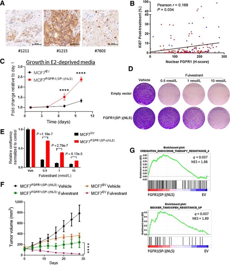 Figure 1. Nuclear FGFR1 promotes antiestrogen resistance. A, Sections of FFPE of ER+/FGFR1-amplified breast primary tumors were subjected to IHC with an FGFR1 antibody as described in the Methods. B, Plot showing direct correlation between nuclear FGFR1 H-Score, measured by IHC, and posttreatment Ki67 in 155 ER+/HER2− breast cancer biopsies from women treated with preoperative letrozole for 10–21 days in the NCT00651976 trial (12, 24). In blue, samples exhibiting FGFR1 amplification (n = 19/155), defined as an FGFR1:CEN8 ratio ≥2.0. C, MCF-7EV and MCF-7FGFR1(SP-)(NLS) cells were seeded in 6-well plates in estrogen-deprived medium. Medium was replenished every 72 hours. Monolayers were stained with crystal violet on days 1, 4, 7, and 10. Quantification of the integrated intensity values as fold change normalized to day 1 (Sidak multiple comparisons test, two-way ANOVA, **** P < 0.0001). D, MCF-7EV and MCF-7FGFR1(SP-)(NLS) cells were seeded in 6-well plates in full medium and treated with vehicle (DMSO) or fulvestrant. After seven days, monolayers were stained with crystal violet. E, Quantification of the integrated intensity values as fold change normalized to vehicle-treated controls (multiple Student t test). F, MCF-7EV and MCF-7FGFR1(SP-)(NSL) xenografts were established in ovariectomized athymic mice implanted with a subcutaneous 14-day release, 0.17-mg 17β-estradiol pellet. Once tumors established, mice were randomized to treatment with vehicle or fulvestrant (5 mg/week). Each data point represents the mean tumor volume in mm3 ± SEM (n = 8 per arm, ****P < 0.0001; two-way ANOVA). G, GSEA of RNA-Seq data for MCF7FGFR1(SP-)(NLS) versus MCF7EV, showing enrichment of gene sets associated with antiestrogen resistance in MCF7FGFR1(SP-)(NLS) cells.