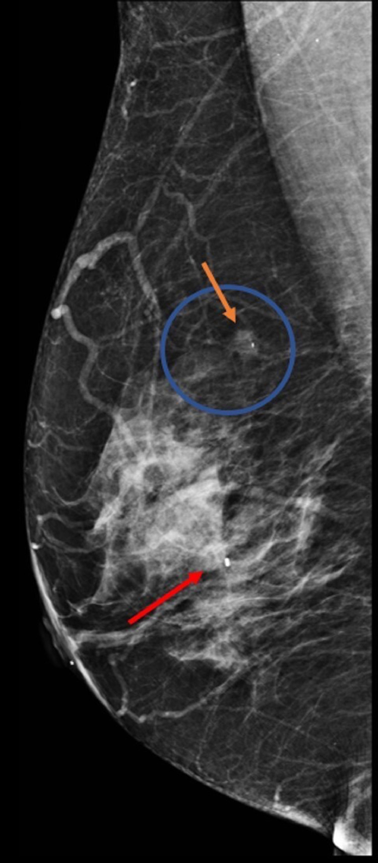 Fig 3 –