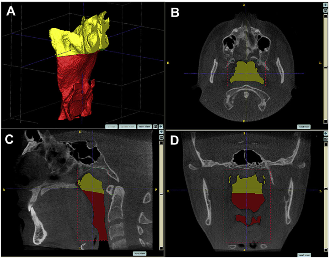 Fig 3