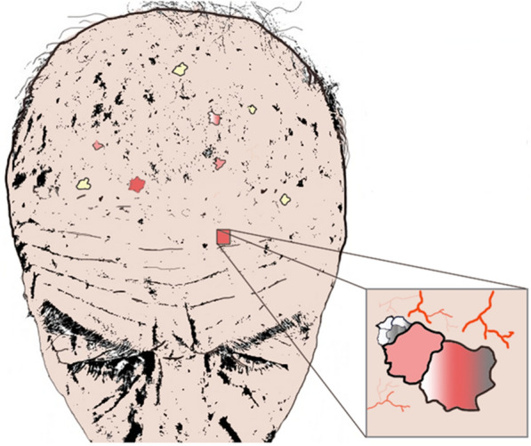 Fig. 1