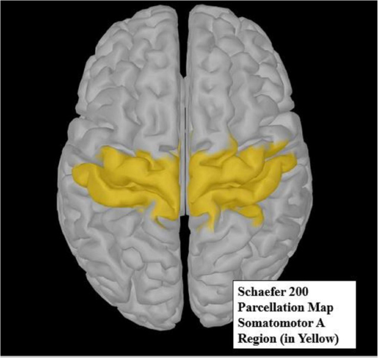 FIGURE 4