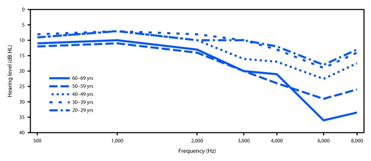 The figure above is a line graph showing the mean audiometric thresholds for persons aged 20–69 years with identified unilateral (right ear only) notches, in the United States using 2011–2012 data from the National Health and Nutrition Examination Survey.