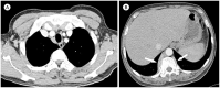 Fig. 11