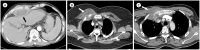 Fig. 12