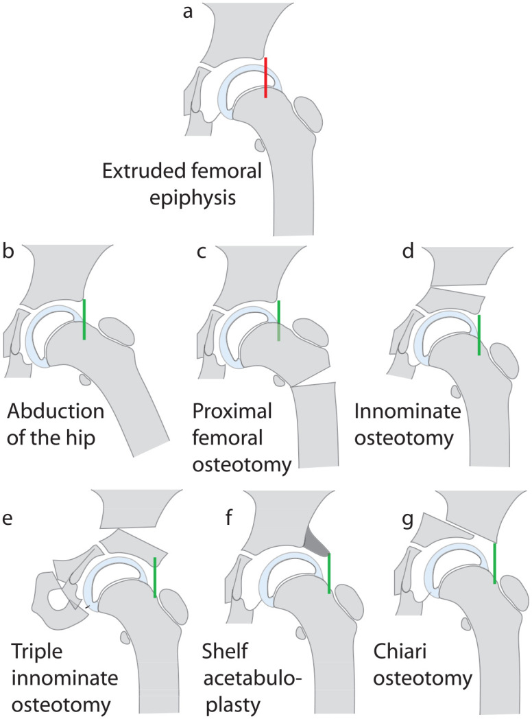 Figure 11.