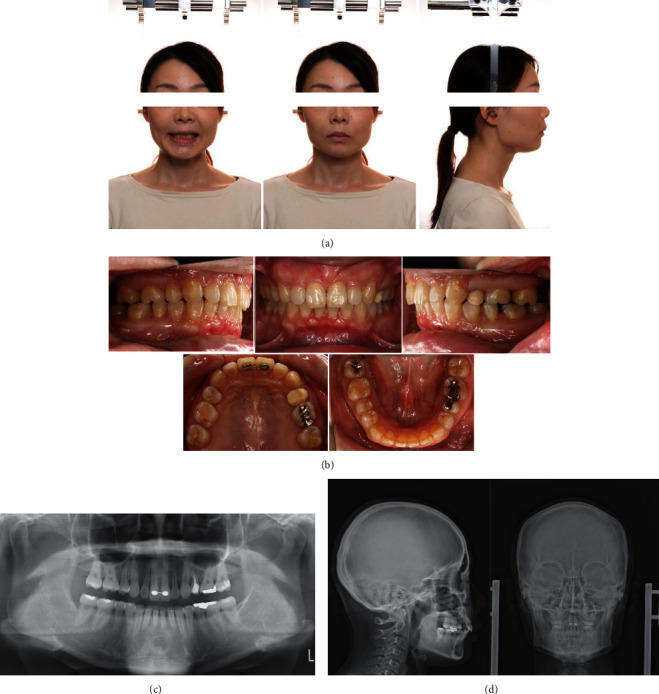 Figure 4