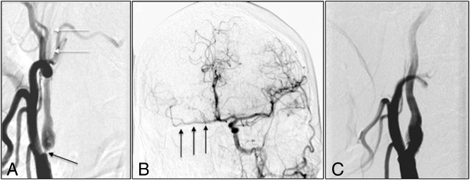 Fig 3.