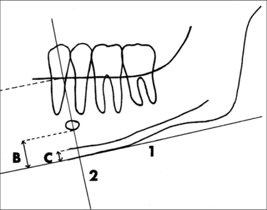 Fig 2.