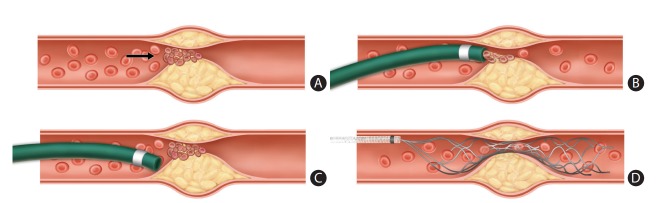 Figure 5.