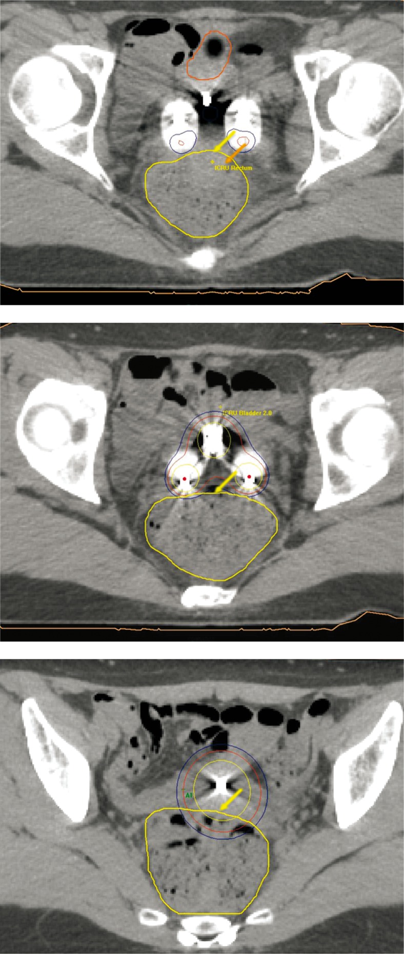 Fig. 3