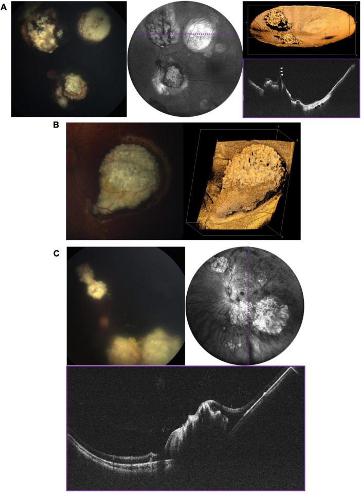 FIGURE 6