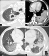 Figure 2 (A-D)
