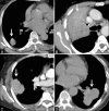 Figure 3 (A-D)