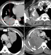 Figure 4 (A-D)